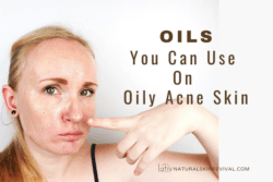 Can You Use Oil On Oily & Acne Skin? - Natural Skin Revival